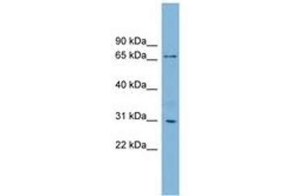 TBCCD1 anticorps  (AA 143-192)