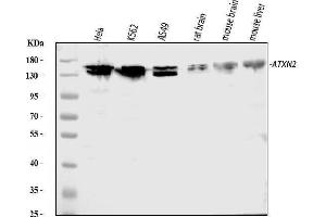 Western blot analysis of ATX2/ATXN2 using anti-ATX2/ATXN2 antibody (ABIN3043507). (Ataxin 2 anticorps  (C-Term))