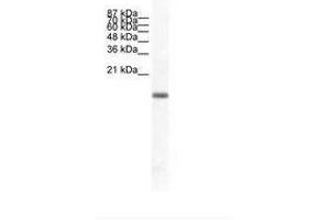 Image no. 1 for anti-Fer3-Like (FERD3L) (N-Term) antibody (ABIN6736019) (FERD3L anticorps  (N-Term))