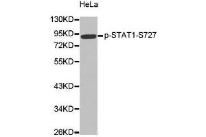 Western blot analysis of extracts from Hela cells, using Phospho-STAT1-S727 antibody. (STAT1 anticorps  (pSer727))