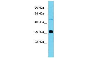 Host:  Rabbit  Target Name:  Mxi1  Sample Type:  Mouse Muscle lysates  Antibody Dilution:  1. (MXI1 anticorps  (N-Term))