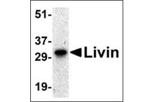 Western blot analysis of Livin expression in human Raji cell lysate with this product at 0.