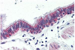Anti-GPR126 antibody  ABIN1048706 IHC staining of human lung, respiratory epithelium. (G Protein-Coupled Receptor 126 anticorps  (Internal Region))