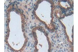 Used in DAB staining on fromalin fixed paraffin- embedded stomach tissue (ENPP1 anticorps  (AA 568-793))