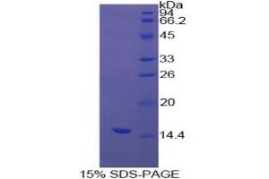 SDS-PAGE analysis of Cow Transthyretin Protein. (TTR Protéine)