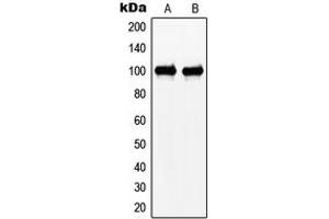 Western blot analysis of N4BP1 expression in HeLa (A), Jurkat (B) whole cell lysates. (N4BP1 anticorps  (Center))