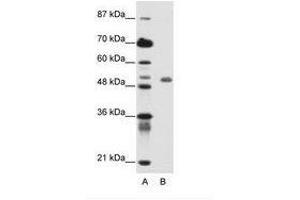 Image no. 1 for anti-Deformed Epidermal Autoregulatory Factor 1 (Drosophila) (DEAF1) (C-Term) antibody (ABIN6736145) (DEAF1 anticorps  (C-Term))