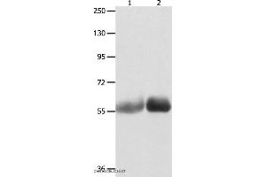 Western blot analysis of Human liver cancer and stomach cancer tissue , using MUTYH Polyclonal Antibody at dilution of 1:1000 (MUTYH anticorps)