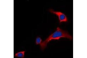 Immunofluorescent analysis of DOK6 staining in COLO205 cells. (DOK6 anticorps)