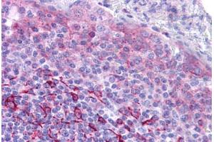 Human Tonsil: Formalin-Fixed, Paraffin-Embedded (FFPE)