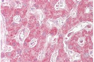 Anti-SIN1 antibody IHC staining of human liver. (MAPKAP1 anticorps  (AA 100-150))