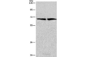 Western blot analysis of Human brain malignant glioma and bladder carcinoma tissue, using CDK5RAP3 Polyclonal Antibody at dilution of 1:449 (CDK5RAP3 anticorps)