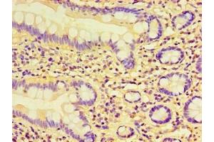 Immunohistochemistry of paraffin-embedded human small intestine tissue using ABIN7157760 at dilution of 1:100 (CCBL1 anticorps  (AA 1-372))