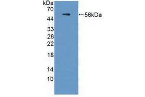 Detection of Recombinant APOL1, Human using Polyclonal Antibody to Apolipoprotein L (APOL1)