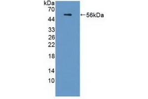 Detection of Recombinant APOL1, Human using Polyclonal Antibody to Apolipoprotein L (APOL1) (APOL1 anticorps  (AA 1-238))