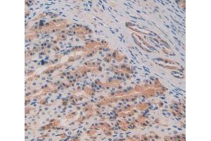 IHC-P analysis of stomach tissue, with DAB staining. (C8B anticorps  (AA 161-503))