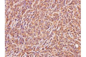 IHC-P Image Immunohistochemical analysis of paraffin-embedded SAS xenograft, using ACMSD, antibody at 1:100 dilution.