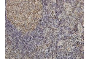 Immunoperoxidase of monoclonal antibody to CDKL4 on formalin-fixed paraffin-embedded human lymph node. (CDKL4 anticorps  (AA 196-295))
