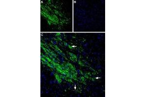 Expression of GIRK2 (Kir3.