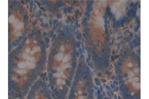 Detection of BFP in Rat Intestine Tissue using Polyclonal Antibody to Brain Finger Protein (BFP)
