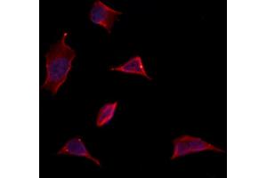 ABIN6263173 and ABIN6273135 staining Hela by IF/ICC.