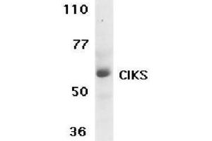 Western Blotting (WB) image for anti-TRAF3 Interacting Protein 2 (TRAF3IP2) (C-Term) antibody (ABIN2472995)