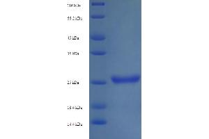 SDS-PAGE (SDS) image for Killer Cell Immunoglobulin Like Receptor 2DS1 (KIR2DS1) (AA 22-245) protein (His tag) (ABIN5714350)