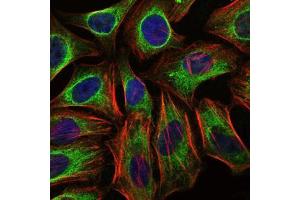 Immunofluorescence analysis of Hela cells using C-CBL mouse mAb (green). (CBL anticorps)