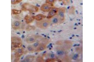 Used in DAB staining on fromalin fixed paraffin-embedded Liver tissue
