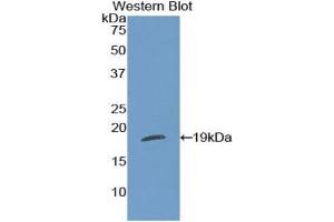 Western blot analysis of the recombinant protein. (Thrombospondin 1 anticorps  (AA 511-670))