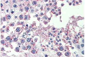 Testis, Human: Formalin-Fixed, Paraffin-Embedded (FFPE) (CPXCR1 anticorps  (AA 396-445))