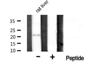 Western blot analysis on rat liver tissue lysate using Bax Antibody (BAX anticorps  (Internal Region))