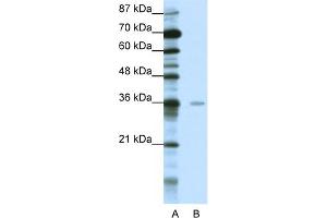 WB Suggested Anti-MBD2 Antibody Titration:  0. (MBD2 anticorps  (Middle Region))