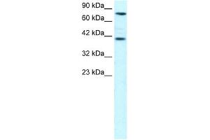 WB Suggested Anti-ZNF652 Antibody Titration: 0. (ZNF652 anticorps  (N-Term))