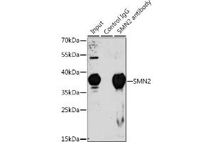 Immunoprecipitation analysis of 200 μg extracts of 293T cells, using 3 μg SMN2 antibody (ABIN6127949, ABIN6148136, ABIN6148139 and ABIN6218739). (SMN2 anticorps  (AA 1-197))