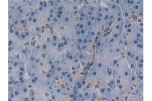 Detection of IL5 in Human Pancreas Tissue using Polyclonal Antibody to Interleukin 5 (IL5)