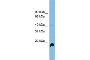 WB Suggested Anti-PPIH Antibody Titration: 0. (PPIH anticorps  (N-Term))