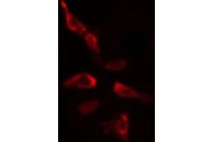 ABIN6275395 staining  HeLa cells by IF/ICC. (SLU7 anticorps  (Internal Region))