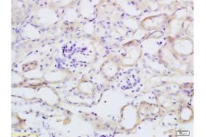 Formalin-fixed and paraffin embedded mouse kidney tissue labeled with Anti-TNFSF18 Polyclonal Antibody, Unconjugated  at 1:200 followed by conjugation to the secondary antibody and DAB staining