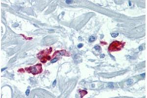 Heart, Human: Formalin-Fixed, Paraffin-Embedded (FFPE)