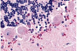 Anti-CELSR3 antibody  ABIN1048436 IHC staining of human brain, Purkinje cell layer.