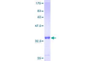 Image no. 1 for S100 Calcium Binding Protein A6 (S100A6) (AA 1-90) protein (GST tag) (ABIN1319065)