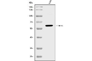 anti-PHD Finger Protein 21B (PHF21B) (AA 291-499) antibody