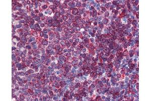 Anti-SC5DL antibody IHC of human tonsil.