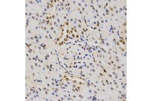 Immunohistochemistry of paraffin-embedded rat kidney tissue using H3K79me3 antibody at dilution of 1:200 (x400 lens). (Histone 3 anticorps  (H3K79me3))