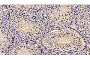 Detection of AST in Mouse Testis Tissue using Monoclonal Antibody to Aspartate Aminotransferase (AST) (GOT1 anticorps  (AA 1-413))