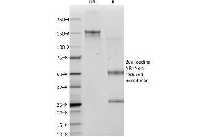 SDS-PAGE Analysis Purified ICOS-L Mouse Monoclonal Antibody (ICOSL/3111).