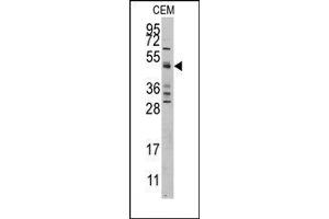 Image no. 1 for anti-Caspase 9, Apoptosis-Related Cysteine Peptidase (CASP9) (Middle Region) antibody (ABIN360397) (Caspase 9 anticorps  (Middle Region))