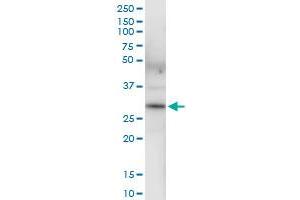 Immunoprecipitation of BDH1 transfected lysate using anti-BDH1 MaxPab rabbit polyclonal antibody and Protein A Magnetic Bead , and immunoblotted with BDH1 purified MaxPab mouse polyclonal antibody (B01P) .