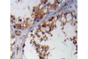 Used in DAB staining on fromalin fixed paraffin-embedded testis tissue (WNK1 anticorps  (AA 1954-2231))